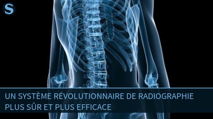 Un système révolutionnaire de radiographie plus sûr et plus efficace