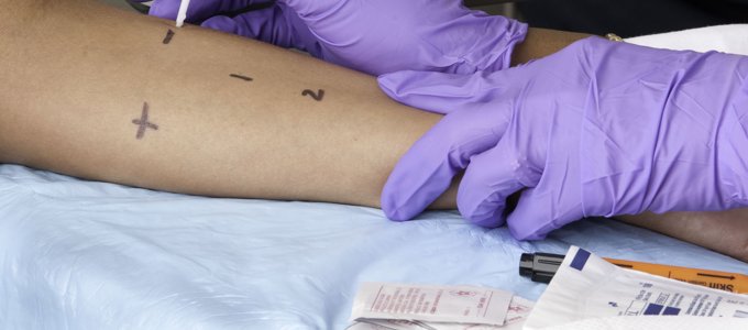 comment traiter allergie test